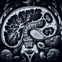 МРТ підшлункової залози