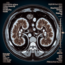 МРТ наднирників